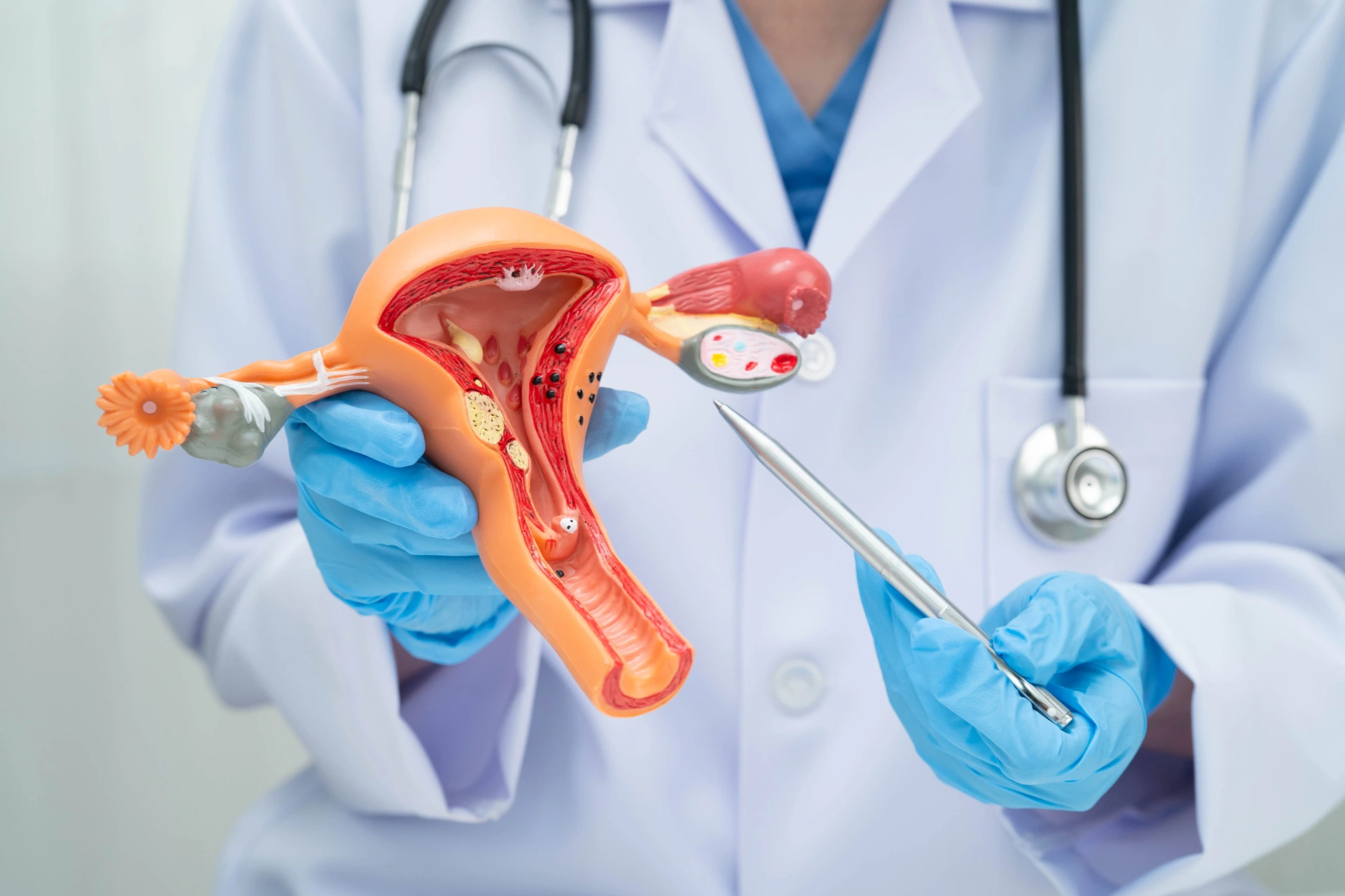 Ovarian Cancer Treatment in Mumbai